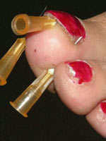 Needles under nails