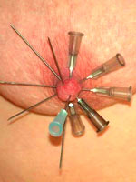 Six needles in one nipple