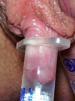 Vacuum stimulating of clitoris