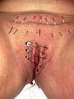 Pussy pierced with needles
